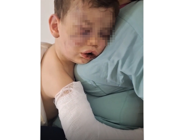 Vahşeti yaşayan 2 yaşındaki bebek hastanelik oldu