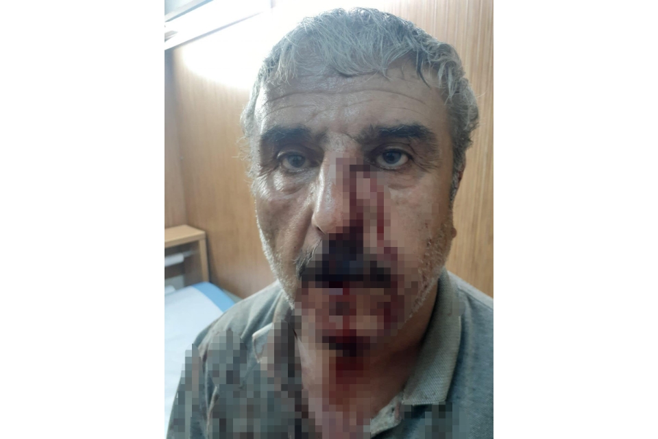 Emekli öğretmen, doktor ile aralarında yaşanan mesai kavgasının detaylarını anlattı