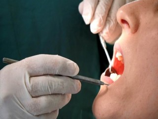 Kırılan diş dolgusu yeni problemlere yol açabilir