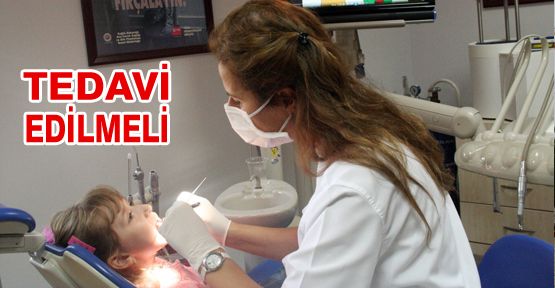 SÜT DİŞLERİ MUTLAKA TEDAVİ EDİLMELİ