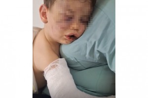Vahşeti yaşayan 2 yaşındaki bebek hastanelik oldu